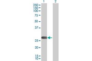 Lane 1: FHL2 transfected lysate ( 32.