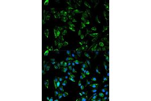 Immunofluorescence analysis of HeLa cell using TPM3 antibody. (TPM3 antibody  (AA 1-284))