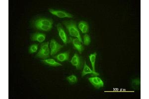 Immunofluorescence of monoclonal antibody to GMFB on HeLa cell.