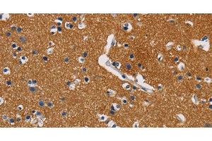 Immunohistochemistry of paraffin-embedded Human brain using GPM6A Polyclonal Antibody at dilution of 1:40 (GPM6A antibody)