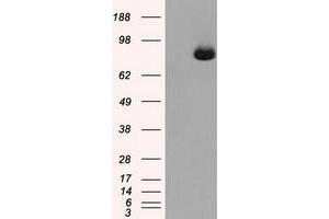 Image no. 6 for anti-Aconitase 2, Mitochondrial (ACO2) antibody (ABIN1496412) (ACO2 antibody)