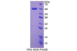 SDS-PAGE (SDS) image for Protein Kinase C, delta (PKCd) (AA 328-674) protein (His tag) (ABIN2126501) (PKC delta Protein (AA 328-674) (His tag))
