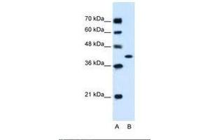 Image no. 2 for anti-Glutamic-Oxaloacetic Transaminase 2, Mitochondrial (Aspartate Aminotransferase 2) (GOT2) (AA 329-378) antibody (ABIN320796)