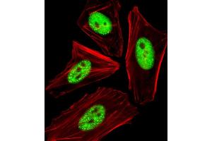 Fluorescent image of HeLa cells stained with Phospho-CDC25A Antibody A. (CDC25A antibody  (pThr507))