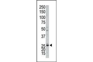 The anti-AK3 Pab (ABIN392736 and ABIN2842196) is used in Western blot to detect AK3 in mouse kidney tissue lysate. (Adenylate Kinase 3 antibody  (C-Term))