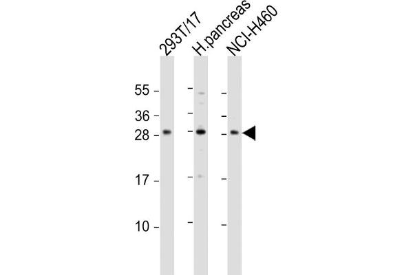 COMTD1 antibody  (C-Term)
