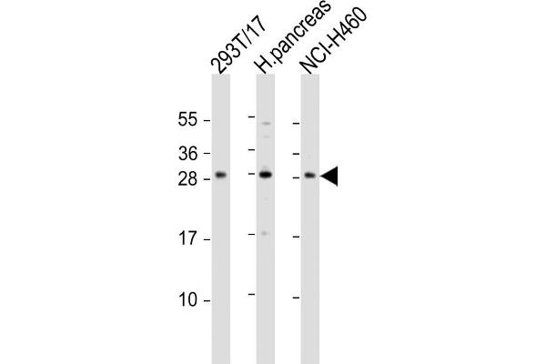 COMTD1 anticorps  (C-Term)