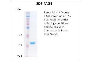 SDS-PAGE (SDS) image for Interleukin 6 (IL6) (Active) protein (ABIN5509357)