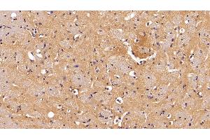 Detection of NME2 in Mouse Cerebrum Tissue using Polyclonal Antibody to Non Metastatic Cells 2, Protein NM23B Expressed In (NME2) (NME2 antibody  (AA 8-149))