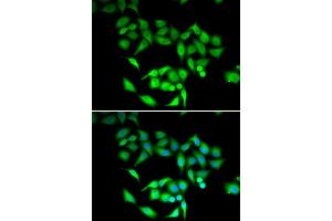 Immunofluorescence analysis of U2OS cells using CCT3 antibody. (CCT3 antibody  (AA 1-300))