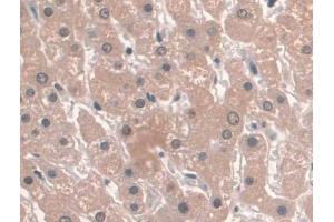 Detection of APOA1 in Human Liver Tissue using Recombinant Antibody to Apolipoprotein A1 (APOA1) (Recombinant APOA1 antibody  (AA 122-267))