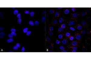 Immunocytochemistry/Immunofluorescence analysis using Mouse Anti-VPS35 Monoclonal Antibody, Clone 8A3 (ABIN6932966). (VPS35 antibody  (APC))
