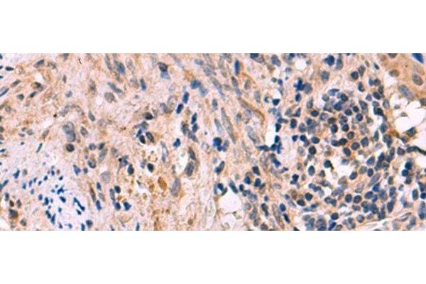 KCNIP1 antibody