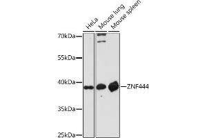 Western blot analysis of extracts of various cell lines, using ZNF444 Rabbit pAb (ABIN7271487) at 1:1000 dilution. (ZNF444 antibody)