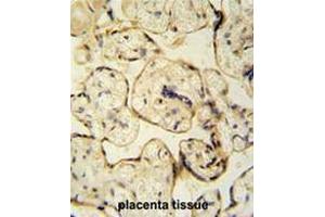 CLIC6 antibody (Center) immunohistochemistry analysis in formalin fixed and paraffin embedded human placenta tissue tissue followed by peroxidase conjugation of the secondary antibody and DAB staining. (CLIC6 antibody  (Middle Region))