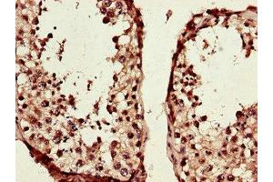 Immunohistochemistry of paraffin-embedded human testis tissue using ABIN7172509 at dilution of 1:100 (TCF3 antibody  (AA 415-658))