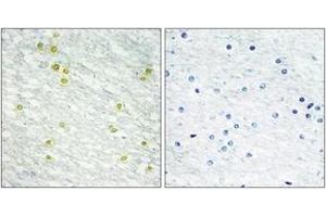 Immunohistochemistry analysis of paraffin-embedded human brain tissue, using MED14 Antibody.