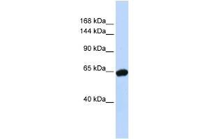 WB Suggested Anti-ZNF91 Antibody Titration:  0.