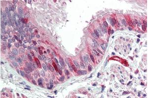 ABIN571026 (5µg/ml) staining of paraffin embedded Human Lung. (CNN3 antibody  (C-Term))