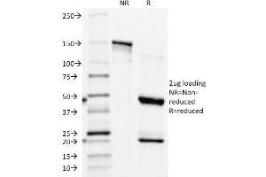 SDS-PAGE Analysis Purified PSAP Mouse Monoclonal Antibody (ACPP/1339). (ACPP antibody)