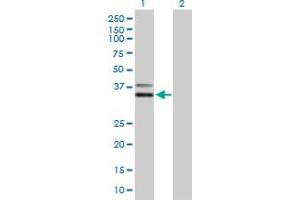 Western Blot analysis of PCGF6 expression in transfected 293T cell line by PCGF6 MaxPab polyclonal antibody. (PCGF6 antibody  (AA 1-277))