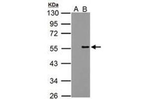 Image no. 1 for anti-Protein Phosphatase 4, Regulatory Subunit 2 (PPP4R2) (AA 1-360) antibody (ABIN1500387)