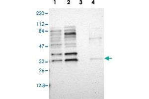 Western blot analysis of Lane 1: RT-4, Lane 2: U-251 MG, Lane 3: Liver, Lane 4: Tonsil with ZNF146 polyclonal antibody  at 1:250-1:500 dilution. (ZNF146 antibody)