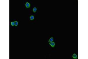 Immunofluorescent analysis of HepG2 cells using ABIN7178869 at dilution of 1:100 and Alexa Fluor 488-congugated AffiniPure Goat Anti-Rabbit IgG(H+L) (GAL4 antibody  (AA 1-324))