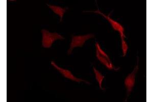 ABIN6275331 staining Hela by IF/ICC. (SLC15A1 antibody  (Internal Region))