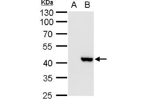 WB Image XRCC3 antibody detects XRCC3 protein by western blot analysis. (XRCC3 antibody)