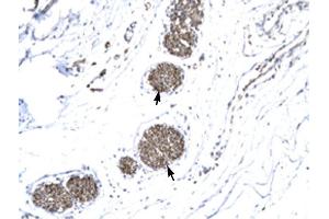 MMP19 antibody was used for immunohistochemistry at a concentration of 4-8 ug/ml to stain Ganglionic cells (arrows) in Human urinary bladder.