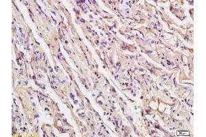 Formalin-fixed and paraffin embedded human endometrial tissue labeled with Anti XRCC4 Polyclonal Antibody, Unconjugated (ABIN1386856) at 1:200 followed by conjugation to the secondary antibody and DAB staining (XRCC4 antibody  (AA 151-260))