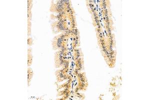 Immunohistochemistry of paraffin embedded mouse duodenum using GDPD2 (ABIN7074098) at dilution of 1:650 (400x lens)