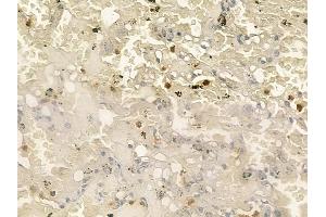 ABIN6258621 and ABIN6273442 at 1/100 staining human normal lung tissue by IHC-P. (CD177 antibody  (Internal Region))