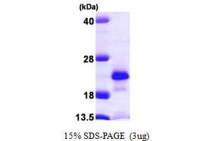 SDS-PAGE (SDS) image for Nudix (Nucleoside Diphosphate Linked Moiety X)-Type Motif 2 (NUDT2) (AA 1-147) protein (His tag) (ABIN667338) (NUDT2 Protein (AA 1-147) (His tag))