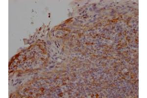 IHC image of ABIN7127389 diluted at 1:100 and staining in paraffin-embedded human tonsil tissue performed on a Leica BondTM system. (Recombinant CCR2 antibody)