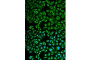 Immunofluorescence analysis of MCF-7 cells using CTSA antibody (ABIN5973211). (CTSA antibody)