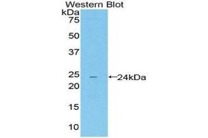 Western Blotting (WB) image for anti-Leukocyte Immunoglobulin-Like Receptor, Subfamily B (With TM and ITIM Domains), Member 4 (LILRB4) (AA 24-206) antibody (ABIN1859666)