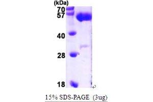 SDS-PAGE (SDS) image for Aldehyde Dehydrogenase 5 Family, Member A1 (ALDH5A1) (AA 48-535) protein (His tag) (ABIN667218) (ALDH5A1 Protein (AA 48-535) (His tag))