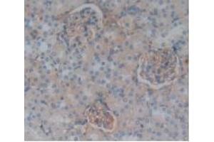 Immunohistochemistry (IHC) image for anti-Complement Factor H (CFH) (AA 975-1217) antibody (ABIN7432280)