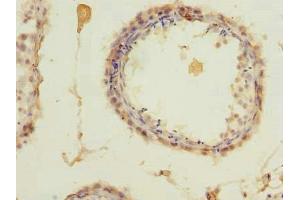 Immunohistochemistry of paraffin-embedded human testis tissue using ABIN7176048 at dilution of 1:100 (ZCCHC4 antibody  (AA 25-229))