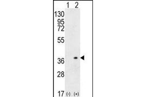 Western blot analysis of HLA-DQA1 (arrow) using rabbit polyclonal HLA-DQA1 Antibody (N-term) (ABIN656108 and ABIN2837859).