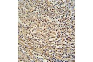 Immunohistochemistry analysis in formalin fixed and paraffin embedded human spleen tissue reacted with Gasdermin C Antibody (Center) followed by peroxidase conjugation of the secondary antibody and DAB staining. (MLZE antibody  (Middle Region))