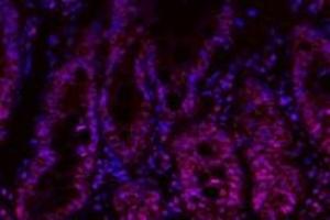 Immunofluorescence (fixed cells) (IF/ICC) image for anti-RNA Polymerase II Associated Protein 2 (RPAP2) antibody (ABIN7075481)