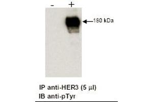 Combined immunoprecipitation and immunoblot of a human cell lysate using anti-HER3 antibody. (ERBB3 antibody  (C-Term))