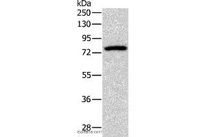 Western blot analysis of Mouse brain tissue, using PRKCG Polyclonal Antibody at dilution of 1:500 (PKC gamma antibody)