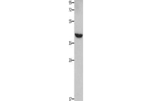 Western Blotting (WB) image for anti-Matrix Metallopeptidase 28 (MMP28) antibody (ABIN2421863) (MMP28 antibody)