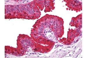 Anti-ABCA5 antibody IHC of human prostate. (ABCA5 antibody)