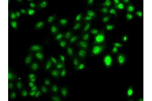 Immunofluorescence analysis of U20S cell using CBFA2T2 antibody. (CBFA2T2 antibody)