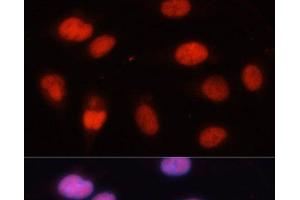 Immunofluorescence (IF) image for anti-Minichromosome Maintenance Complex Component 5 (MCM5) antibody (ABIN7257096)